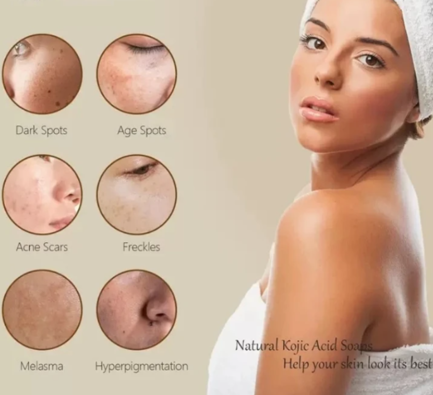Illuminating Turmeric & Kojic Soap Bar for Face and Body - Skin Lightening Formula