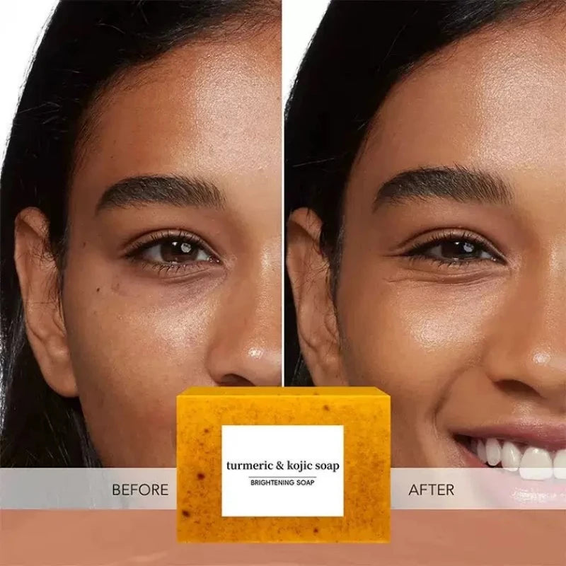 Illuminating Turmeric & Kojic Soap Bar for Face and Body -  Skin Lightening Formula