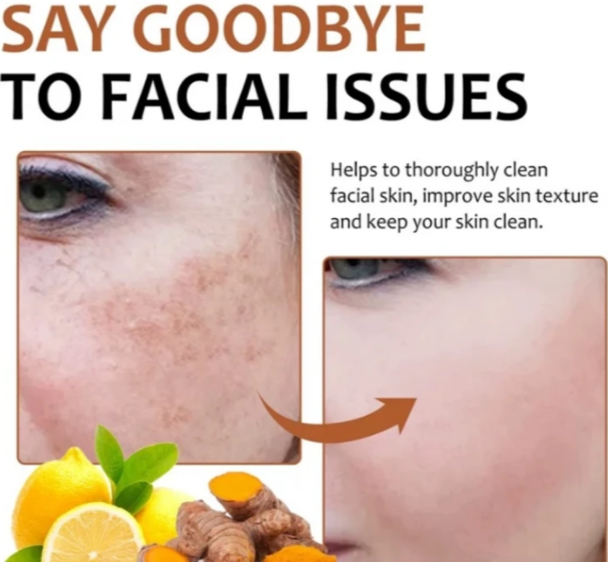 Illuminating Turmeric & Kojic Soap Bar for Face and Body -  Skin Lightening Formula