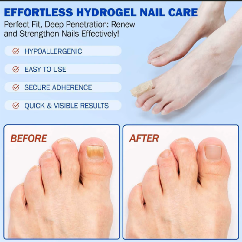 Nail Repair Patches - Professional Toenail Care Stickers for Restoring Healthy Nails