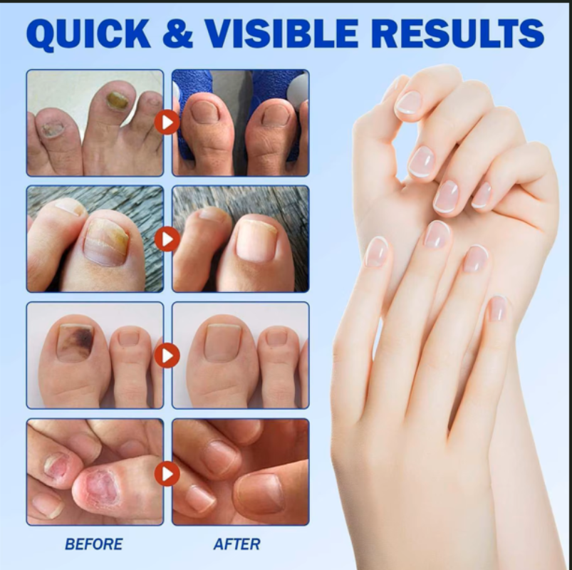 Nail Repair Patches - Professional Toenail Care Stickers for Restoring Healthy Nails