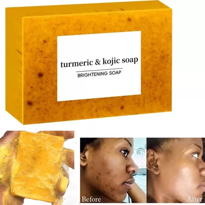 Illuminating Turmeric & Kojic Soap Bar for Face and Body -  Skin Lightening Formula
