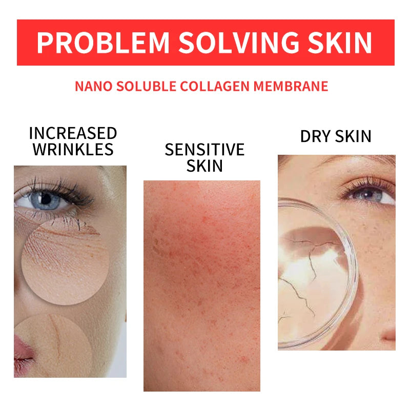 Pack of 5 Hydrolyzed Collagen Protein Gel Face Masks - Soluble Skin Care Treatment